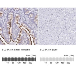 SGLT1/SLC5A1 Antibody, Novus Biologicals 0.1mL; Unlabeled:Antibodies, Polyclonal